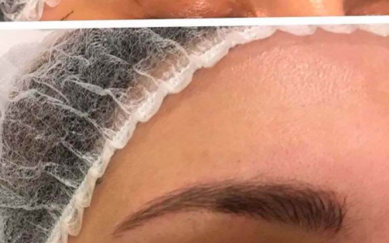 Imagen del antes y el después de tratamiento de cejas