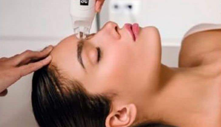RADIOFRECUENCIA FACIAL