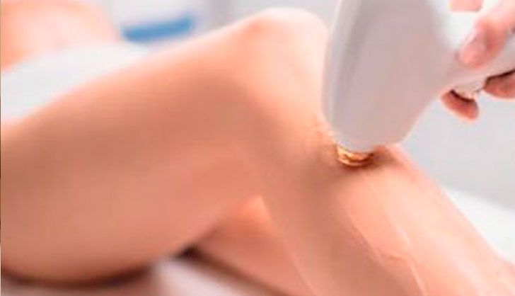 radiofrecuencia corporal